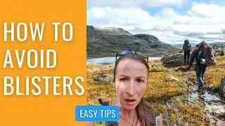 HOW TO NEVER GET HIKING BLISTERS AGAIN | 8 EASY TIPS TO AVOID FOOT BLISTERS