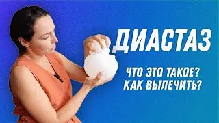 Диастаз что это? Как определить? Как лечить? | Остеопат Марина Просветина