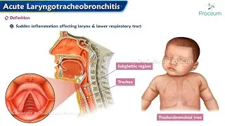 Acute Laryngotracheobronchitis (Croup) 🗣️:  ENT Lectures