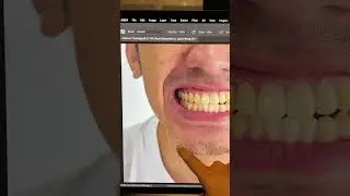 Easiest Way to Whiten Teeth in Photoshop! #Shorts