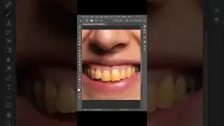 whiten teeth in 