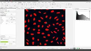 Image-Pro v11: Cell Biology Protocols - Autophagy