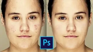 Как убрать прыщи и почистить кожу на фото в фотошопе