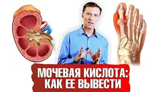 Мочевая кислота. Как вывести ее из организма? ☝️