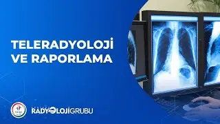 Teleradyoloji ve Raporlama Nedir? I Radyoloji Grubu