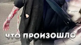 Курсед рассказал, как его пырнули ножом на улице