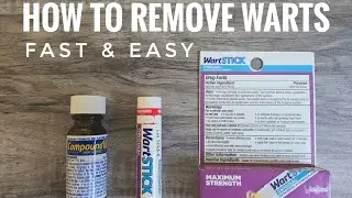 How to Remove Warts Skin Tags Moles FAST 40% Strength Wart Stick