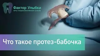 Что такое протез - бабочка? Когда используют данный съемный протез?