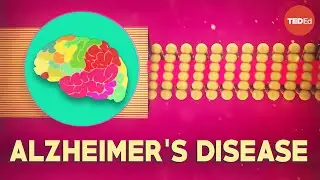 What is Alzheimers disease? - Ivan Seah Yu Jun