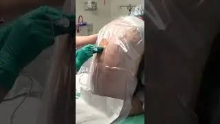 Extracción de la aguja epidural #medicina #elcirujano #aprender #doctor #epidural #cirguría #parati